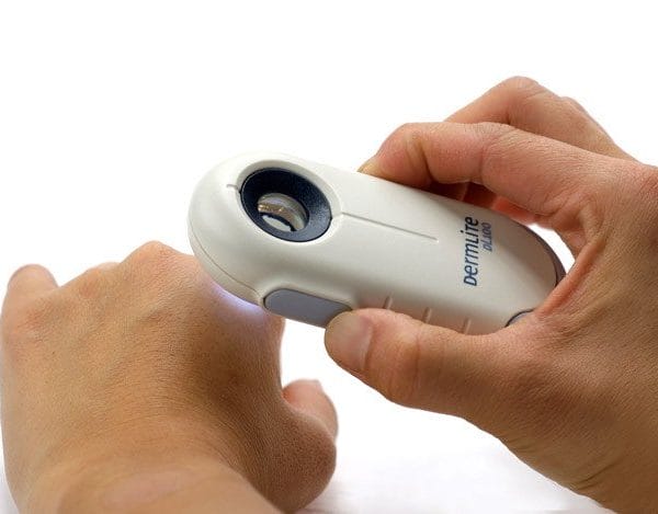 Dermlite es una marca de dermatoscopios que ofrece dispositivos de alta calidad para la dermatología clínica.